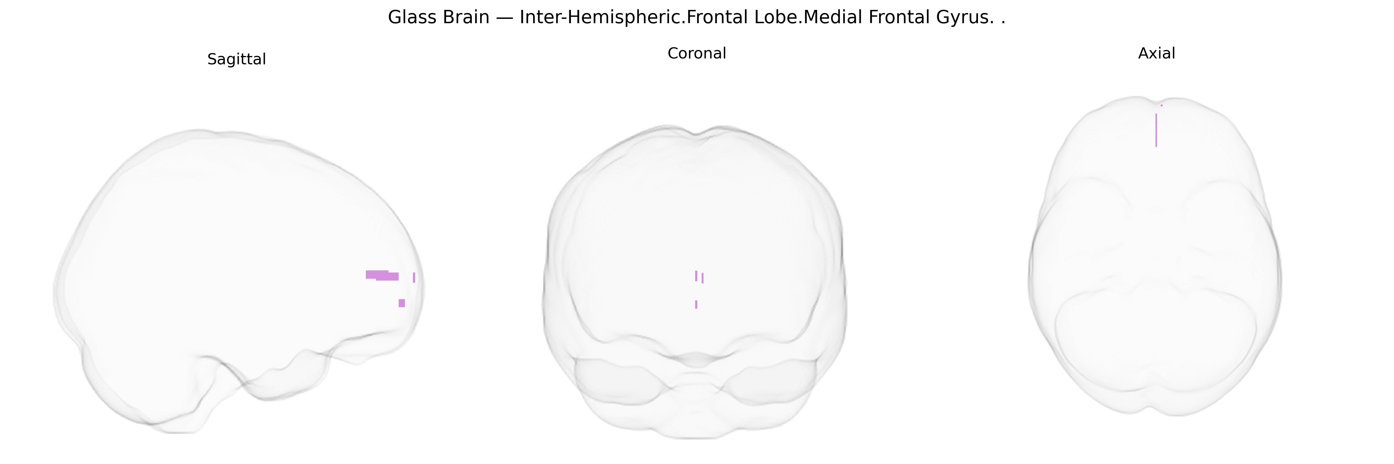 Triplanar Ghost Brain