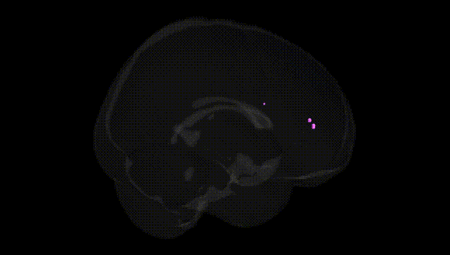 Full Brain Black