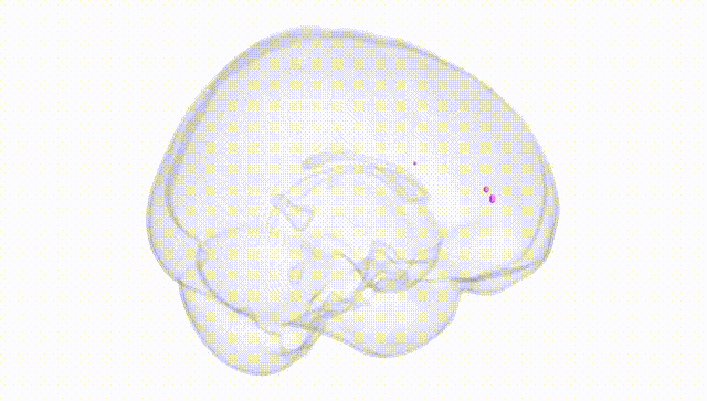 Full Brain White