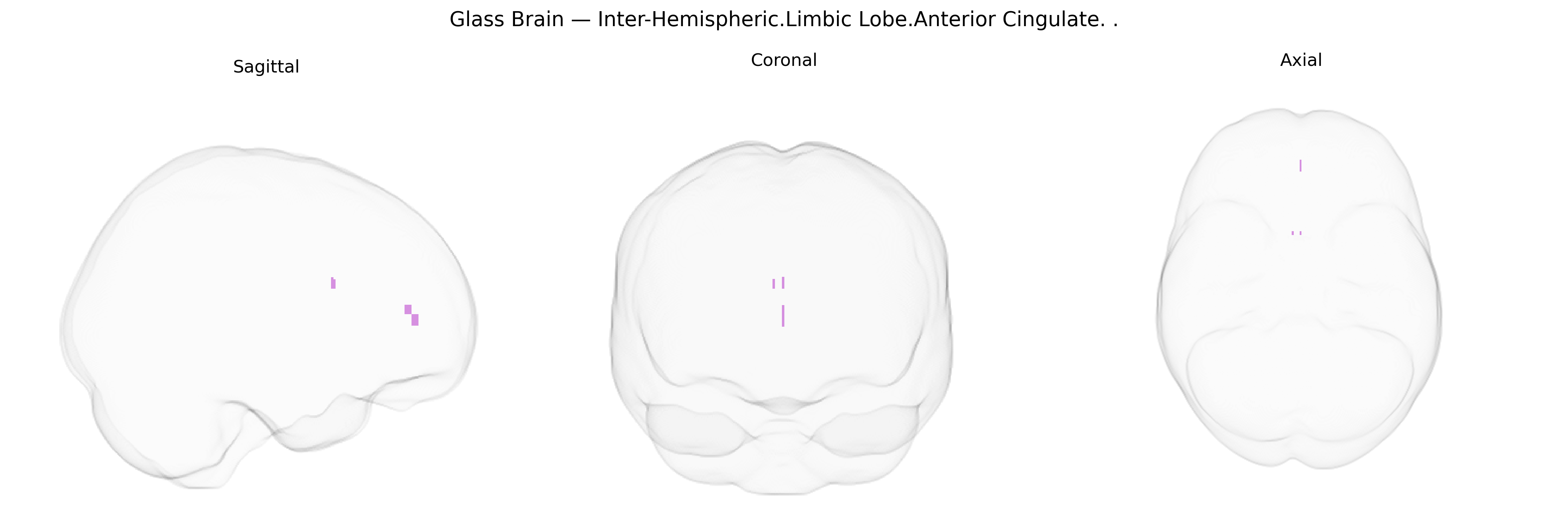 Triplanar Ghost Brain