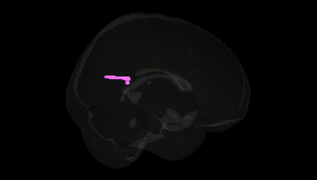 Full Brain Black