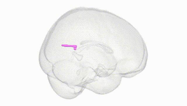 Full Brain White