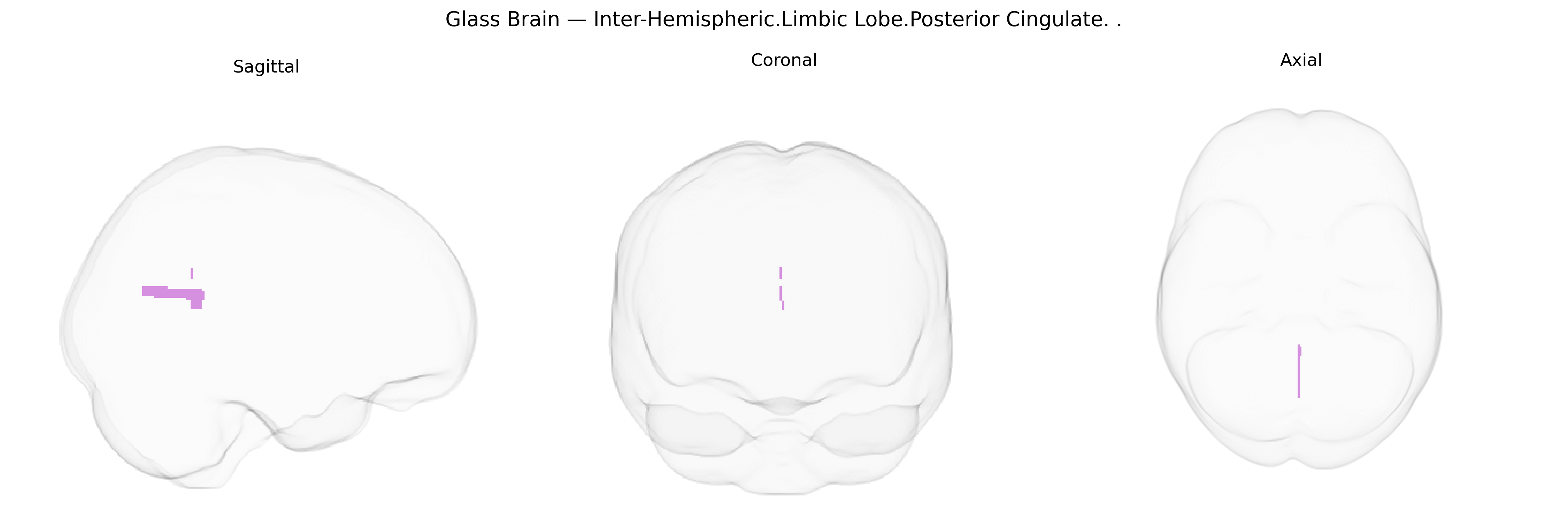 Triplanar Ghost Brain