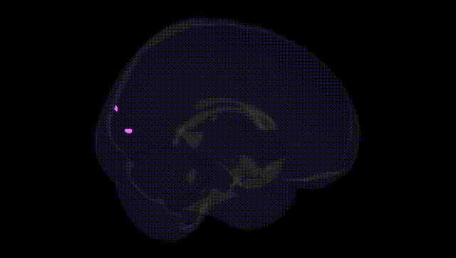 Full Brain Black