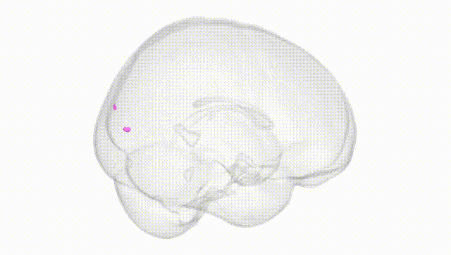 Full Brain White