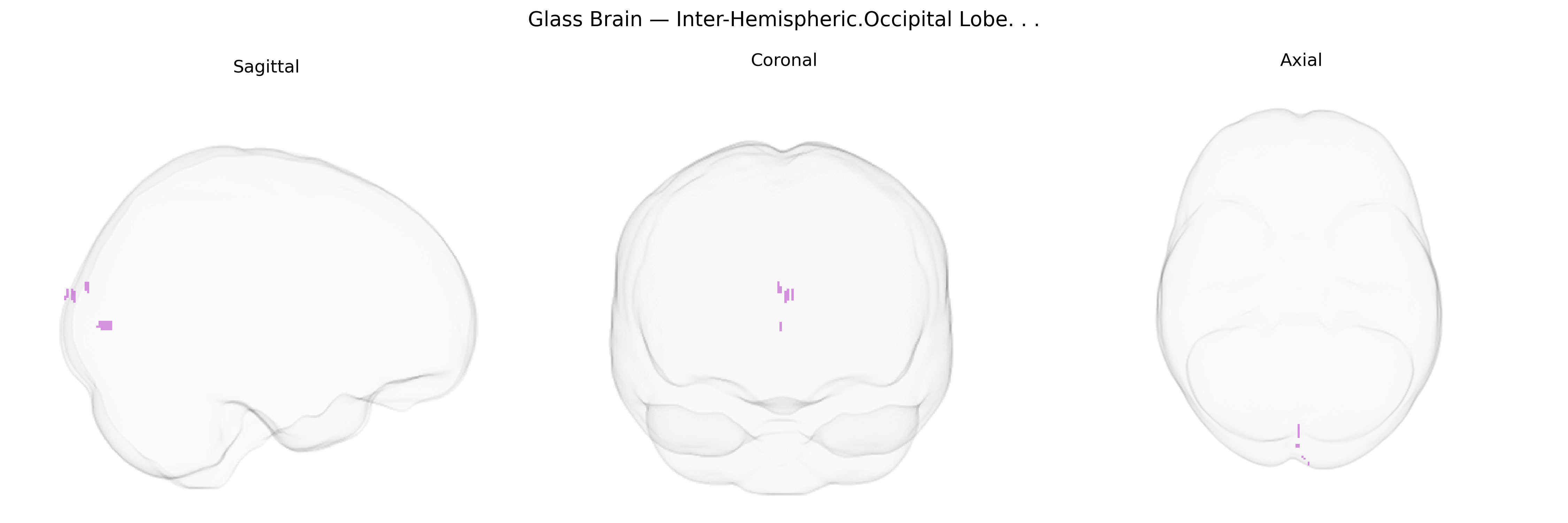 Triplanar Ghost Brain