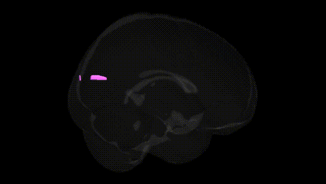 Full Brain Black