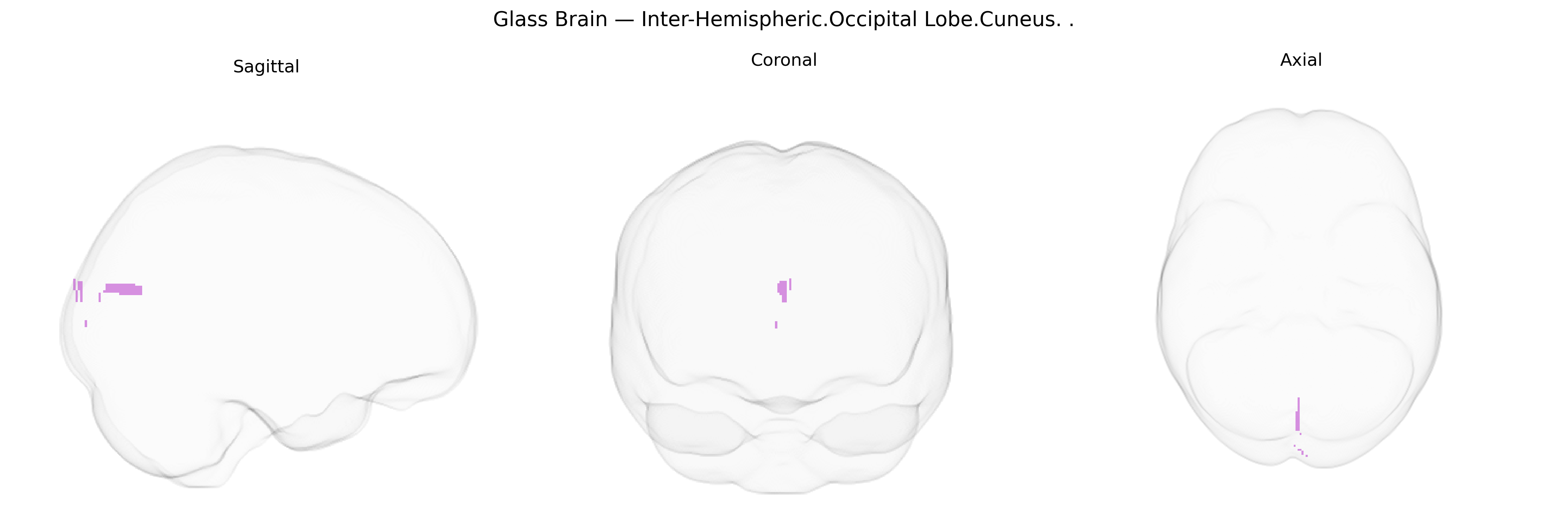 Triplanar Ghost Brain