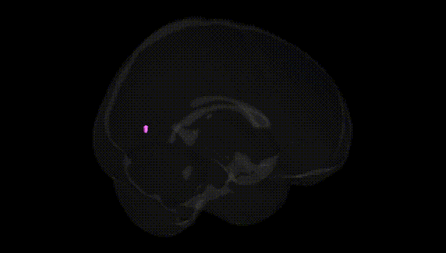 Full Brain Black