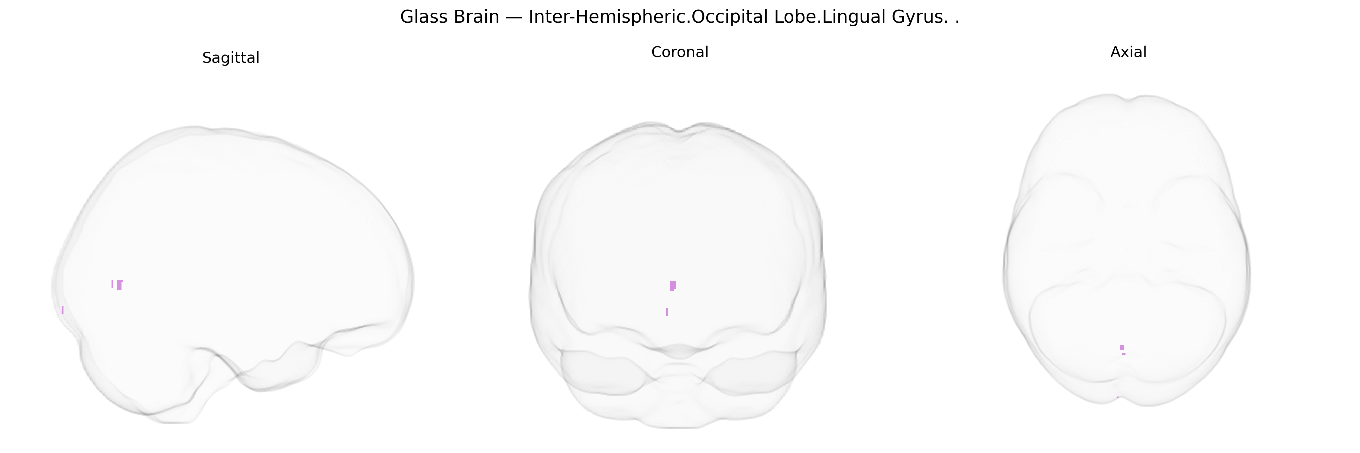 Triplanar Ghost Brain