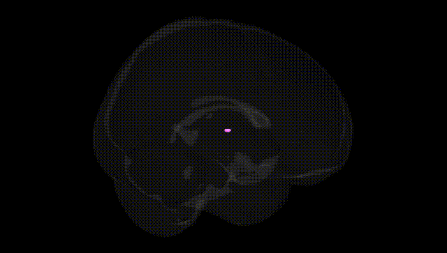Full Brain Black