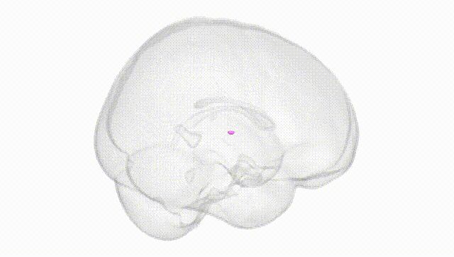 Full Brain White