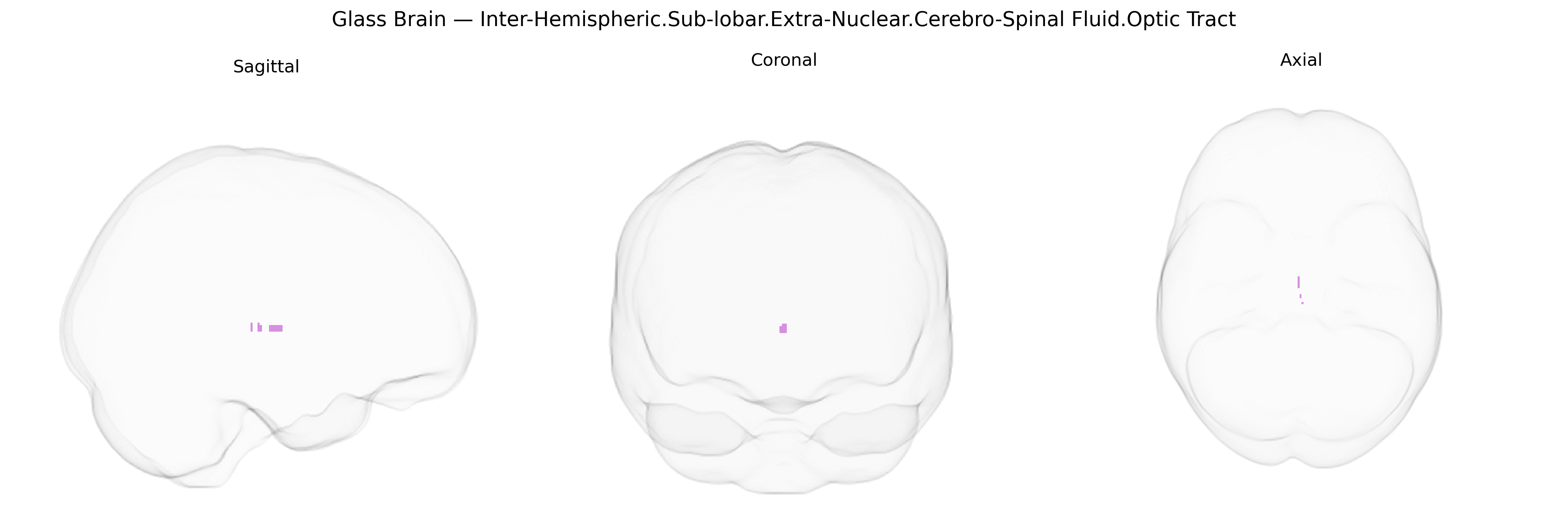 Triplanar Ghost Brain