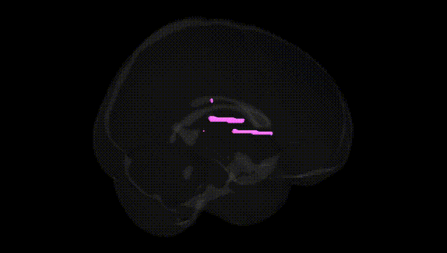 Full Brain Black