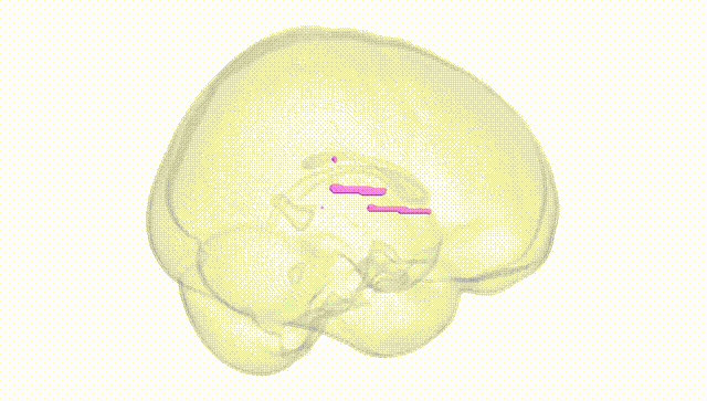 Full Brain White