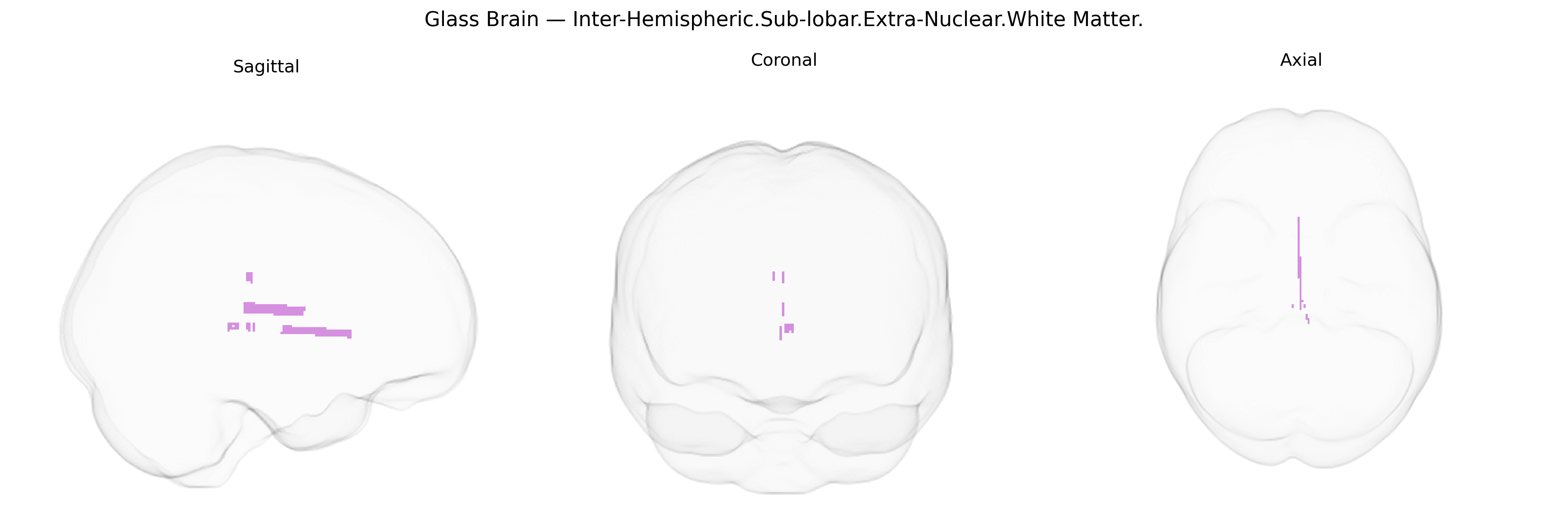 Triplanar Ghost Brain