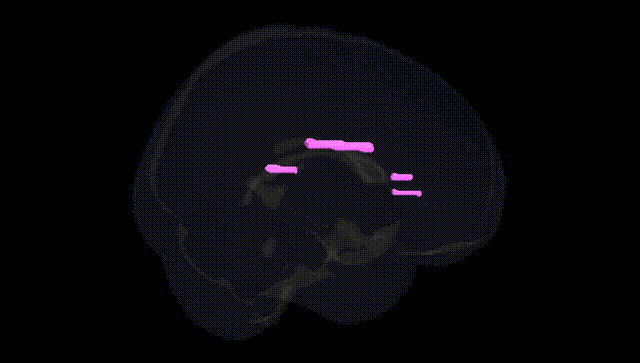 Full Brain Black