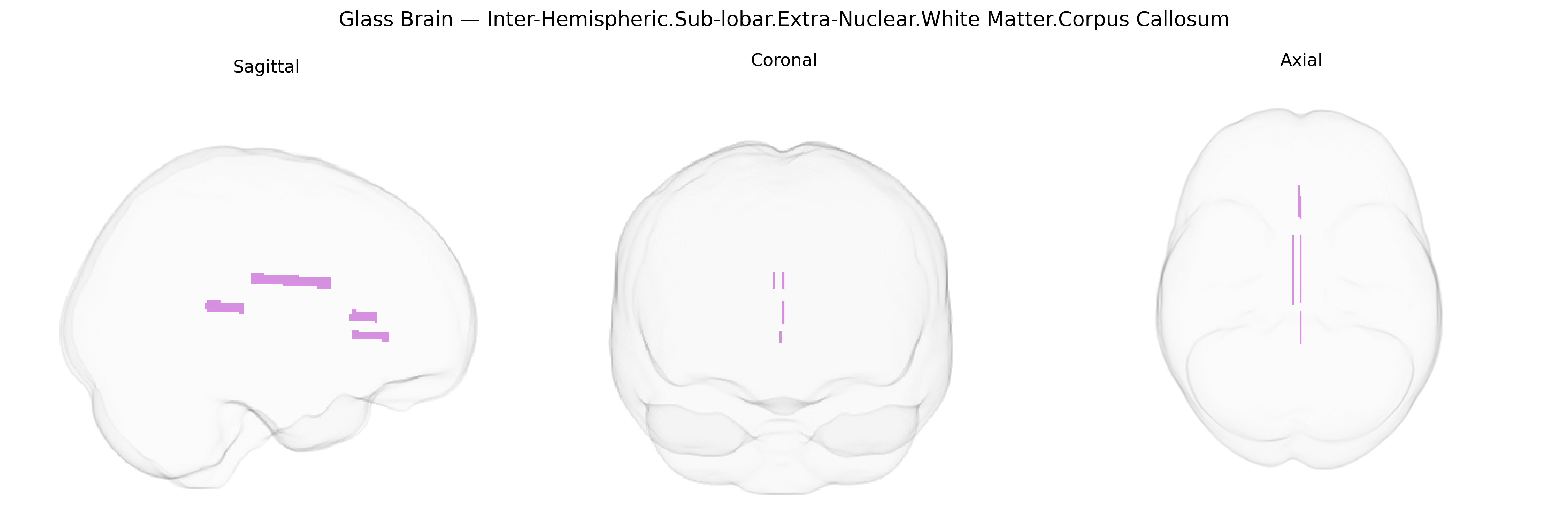Triplanar Ghost Brain