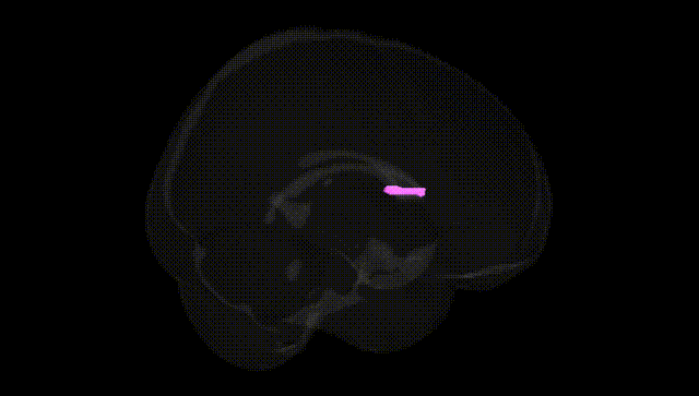 Full Brain Black