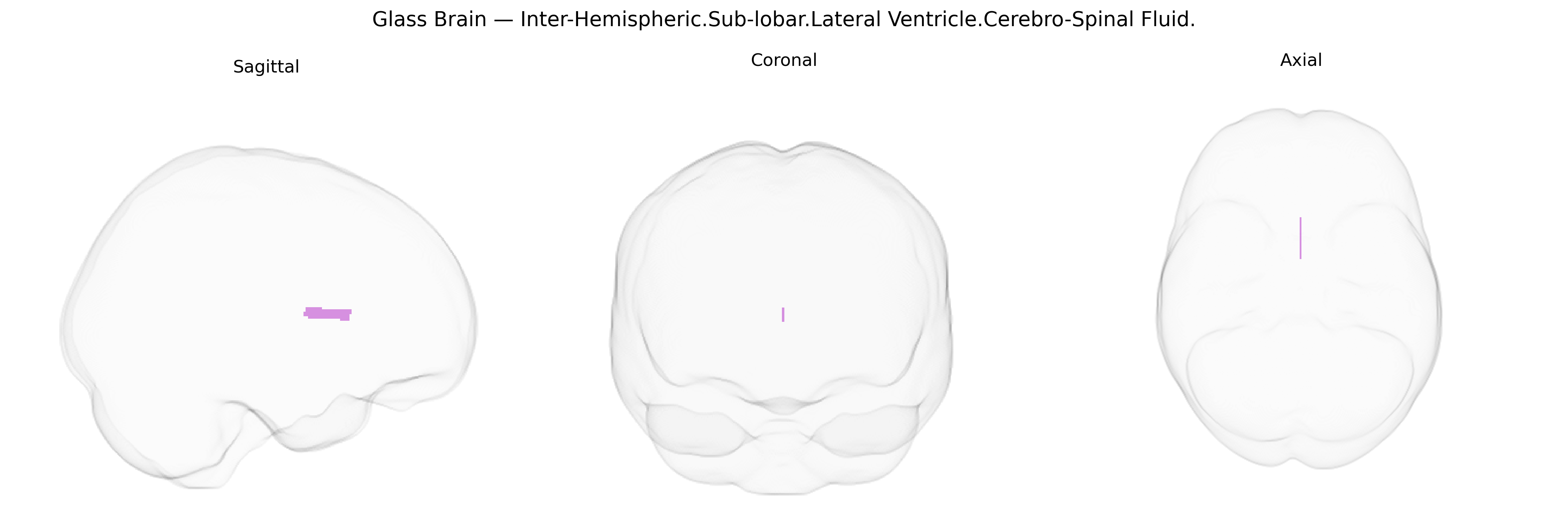 Triplanar Ghost Brain