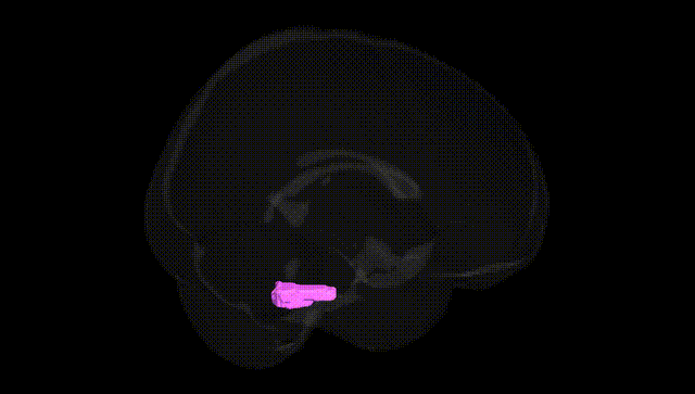 Full Brain Black