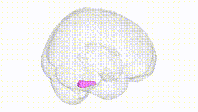 Full Brain White