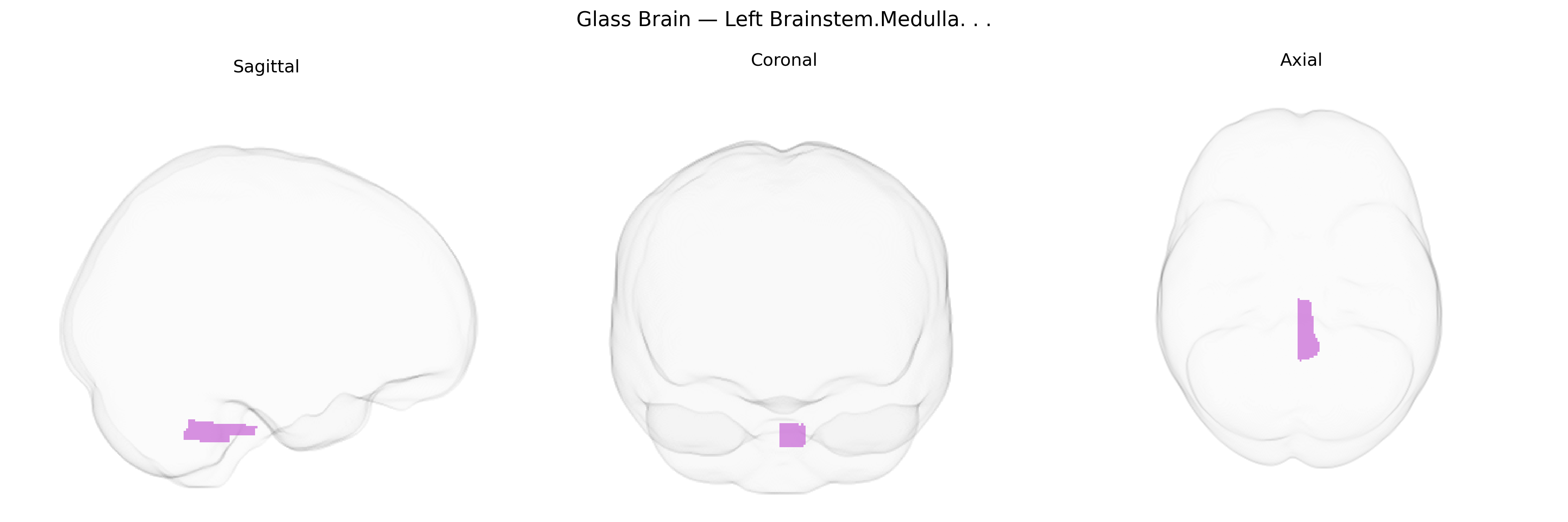 Triplanar Ghost Brain