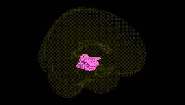 Full Brain Black