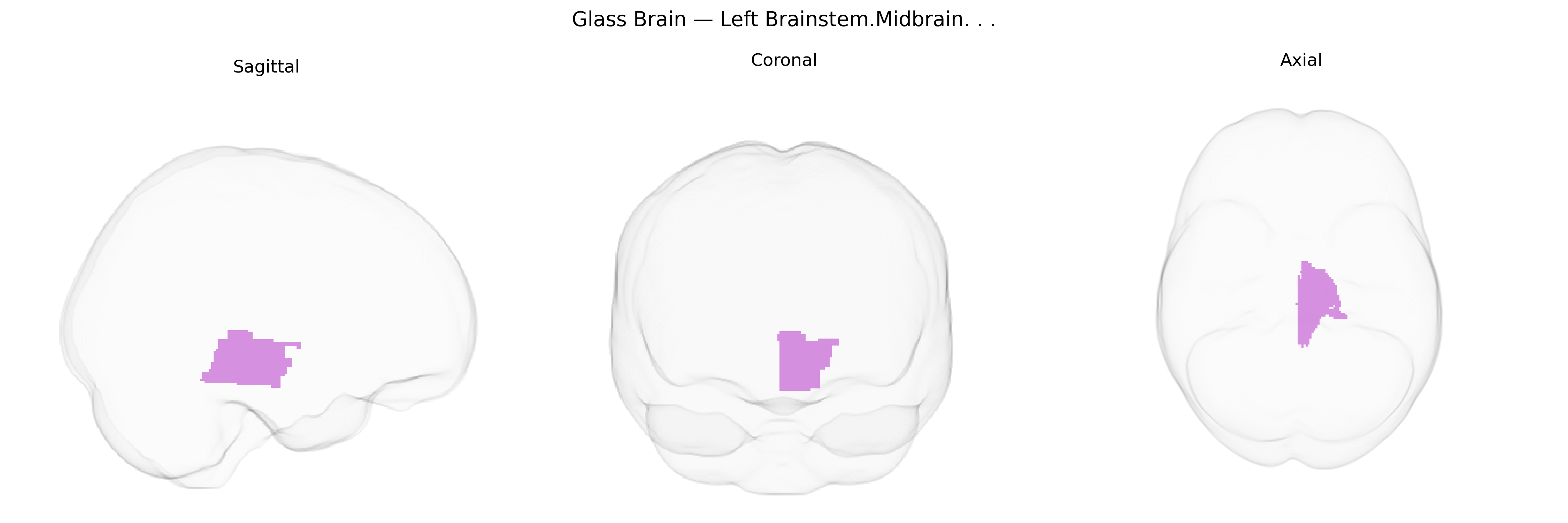 Triplanar Ghost Brain