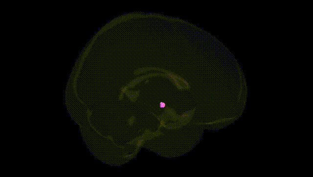 Full Brain Black