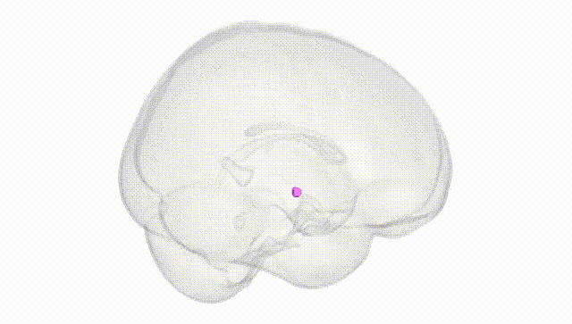 Full Brain White