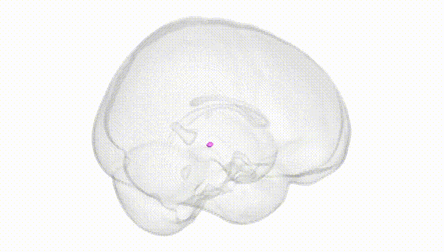 Full Brain White