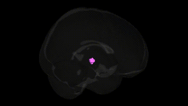 Full Brain Black