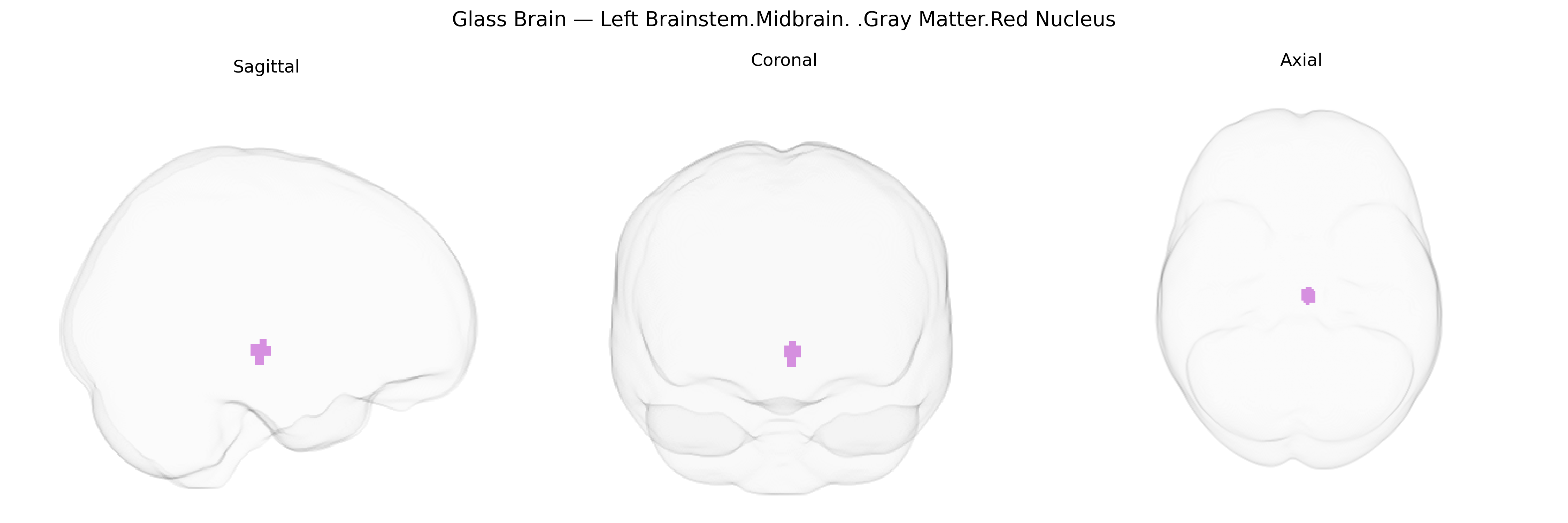 Triplanar Ghost Brain