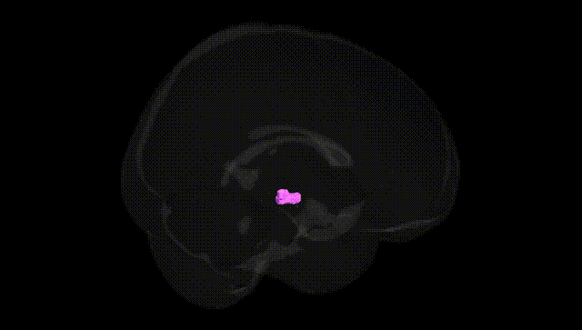 Full Brain Black