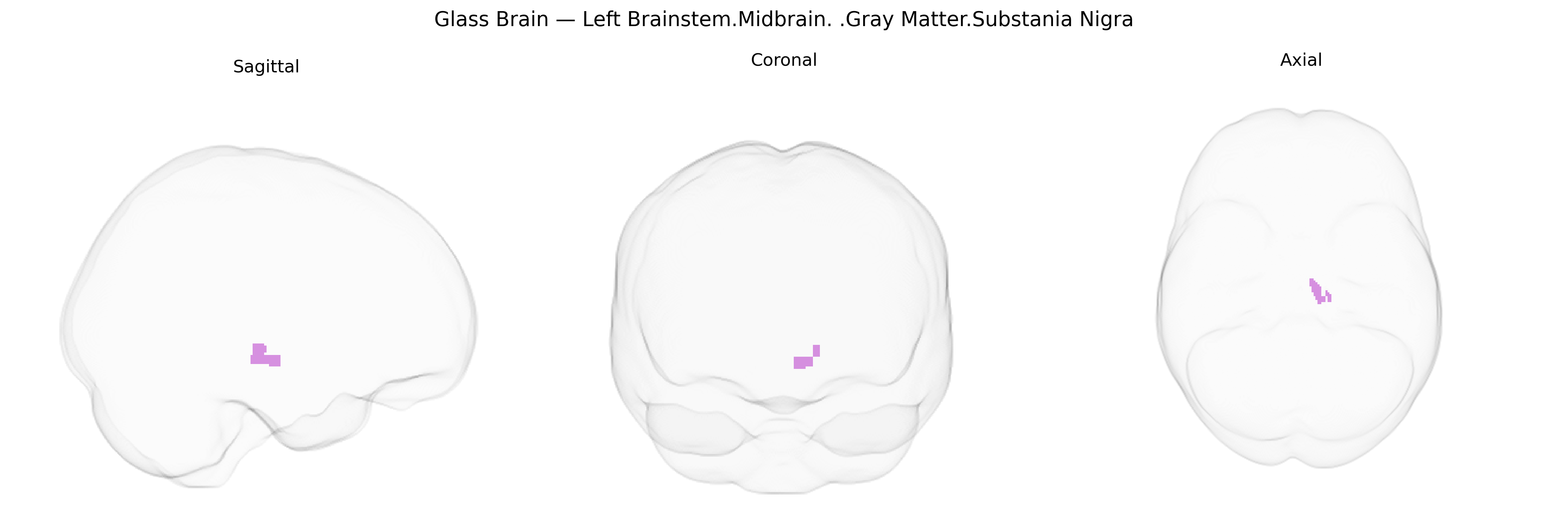 Triplanar Ghost Brain