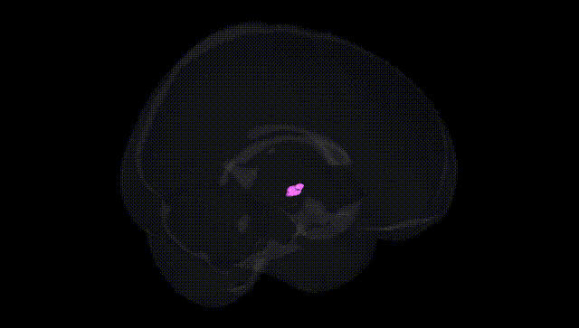 Full Brain Black