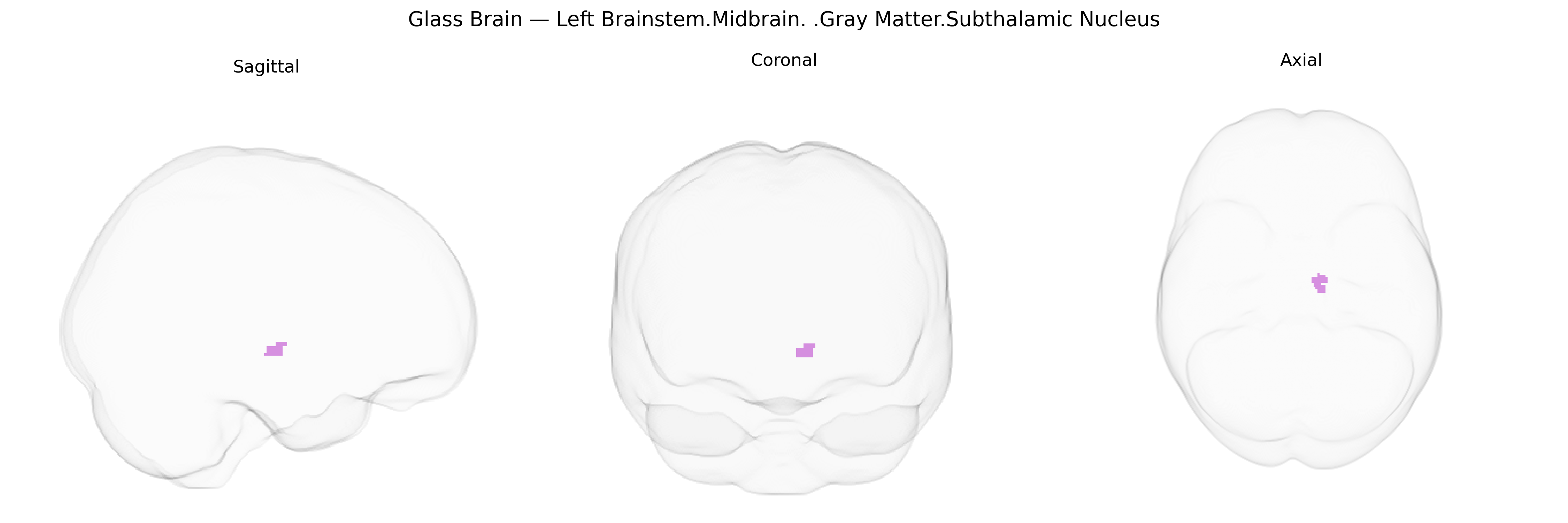 Triplanar Ghost Brain