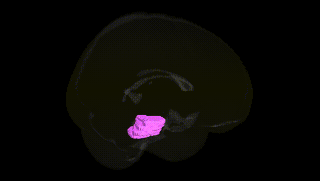 Full Brain Black
