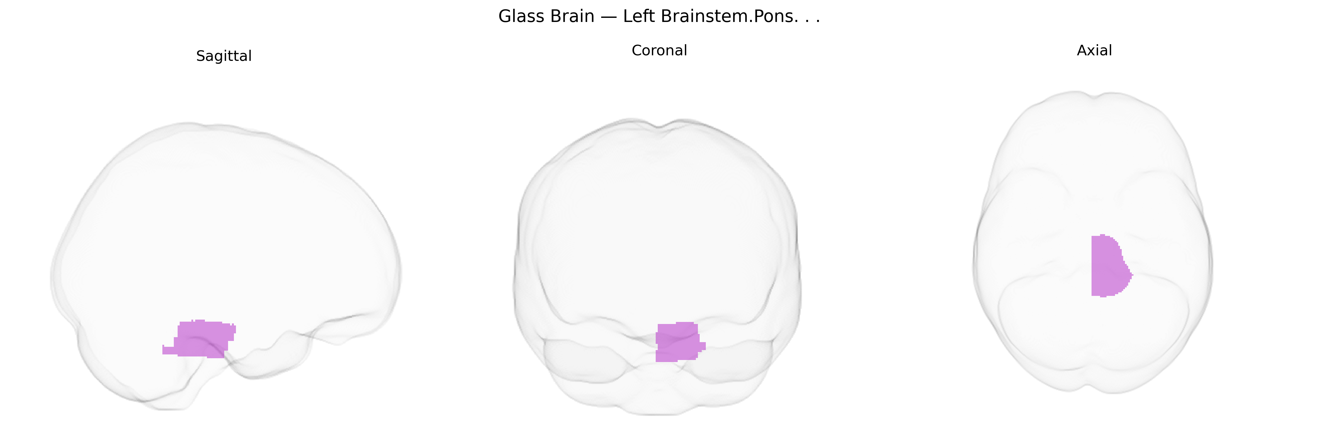 Triplanar Ghost Brain