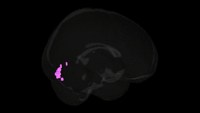 Full Brain Black