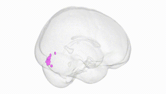 Full Brain White