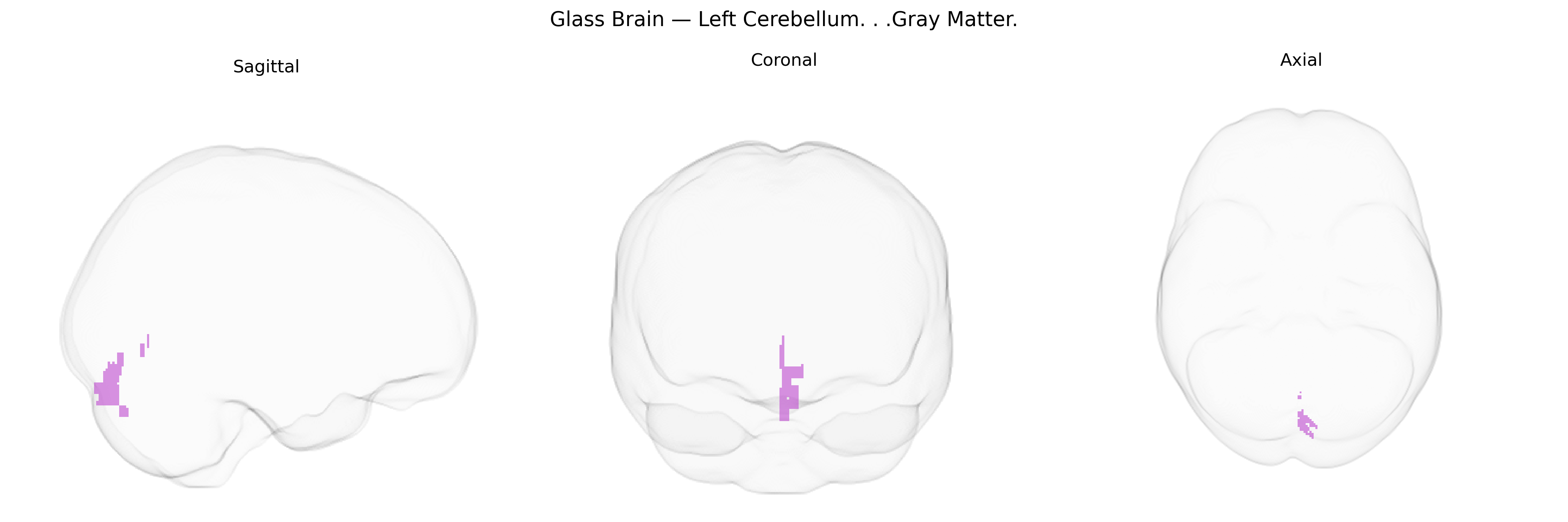 Triplanar Ghost Brain