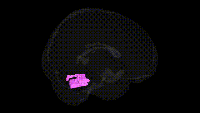 Full Brain Black