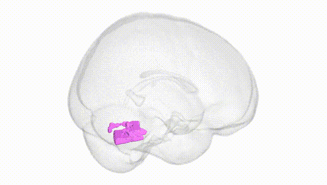 Full Brain White