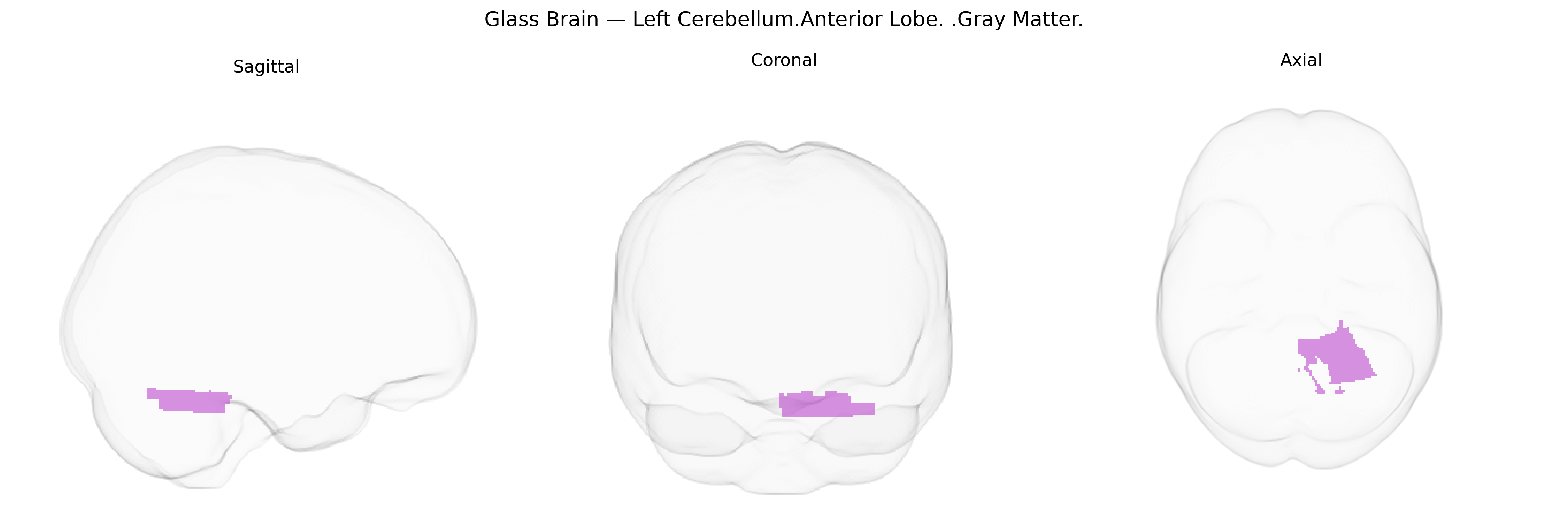 Triplanar Ghost Brain