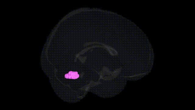 Full Brain Black