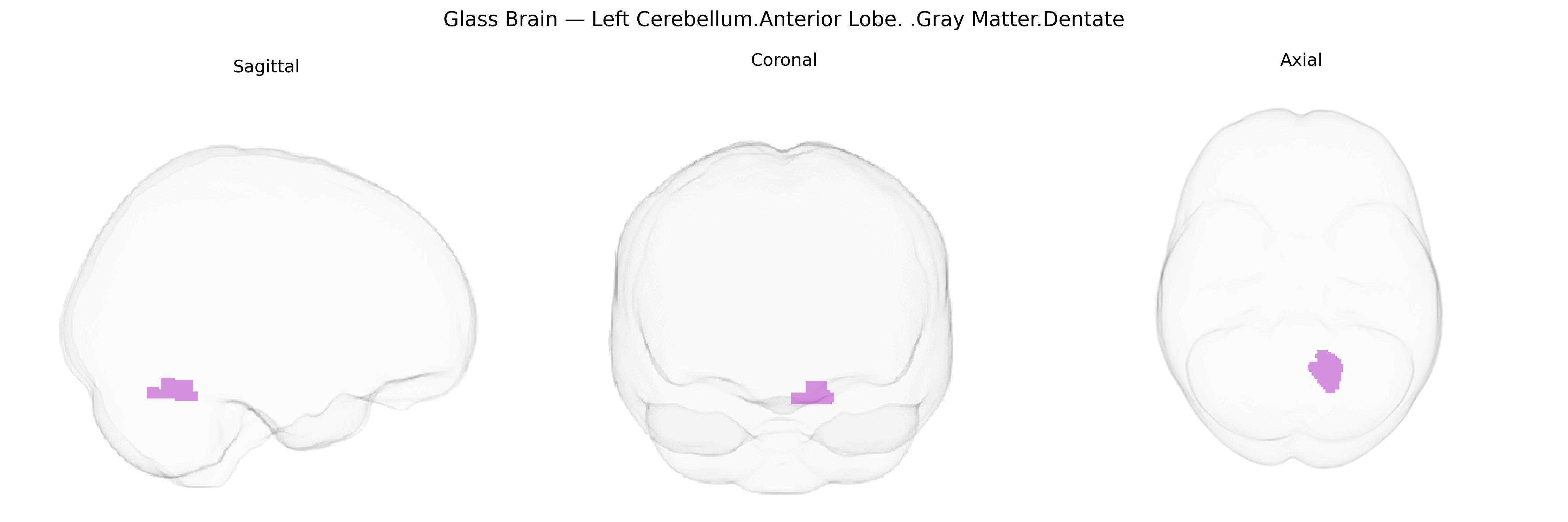 Triplanar Ghost Brain