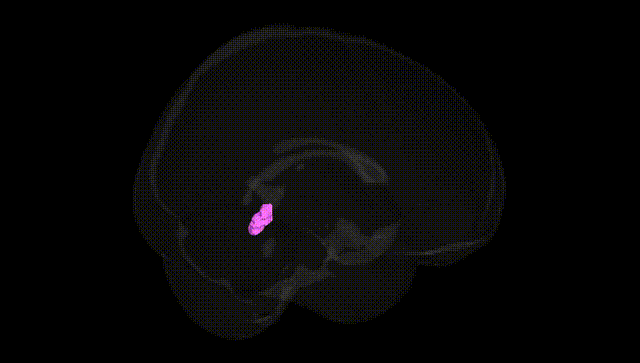 Full Brain Black