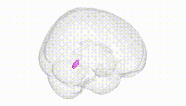 Full Brain White
